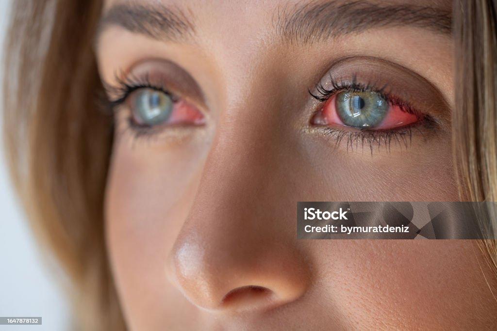 Kan damlaları - Ama